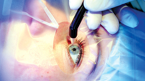 Лазерное лечение глаз в волгограде thumbnail